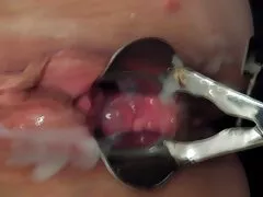 Spekulum creampie